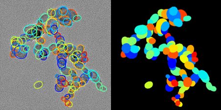 电镜图像分割示例